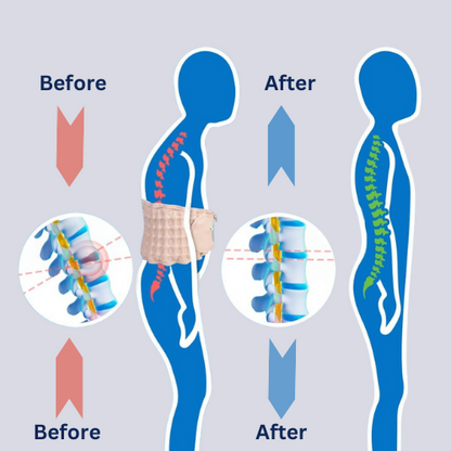 Kulax Adjustable Back Support Belt with one-touch air inflation for lumbar decompression